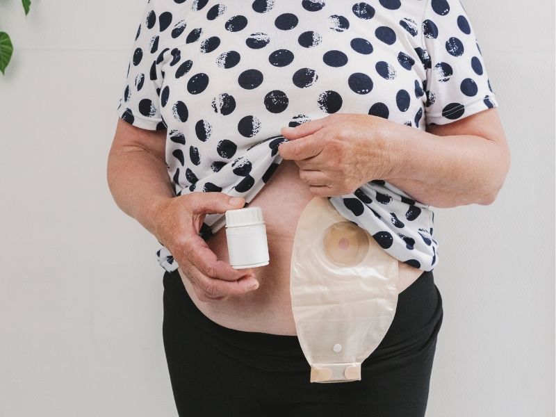 Ng - Pek Stoma Bakımı